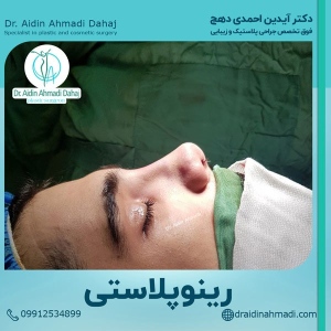 جراحی-بینی-