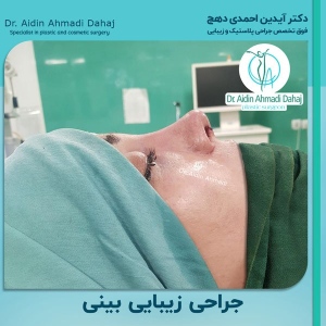 جراحی-بینی-1