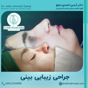 جراحی-بینی-14
