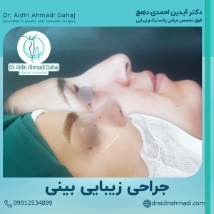 جراحی-بینی-3