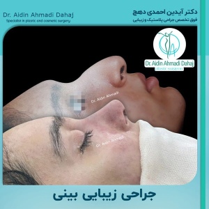 جراحی-بینی-8