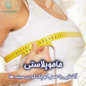 ماموپلاستی - دکتر آیدین احمدی دهج