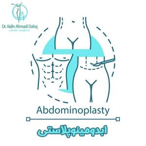 ابدومینوپلاستی - دکتر آیدین احمدی دهج