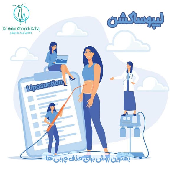 لیپوساکشن - دکتر آیدین احمدی دهج
