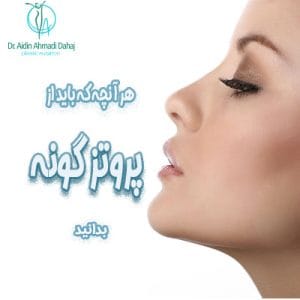پروتز گونه - دکتر آیدین احمدی دهج