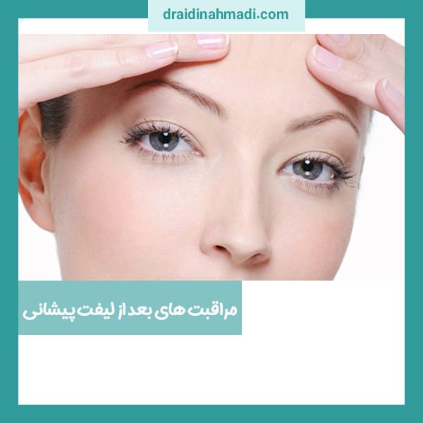 مراقبت های بعد از لیفت پیشانی - https://draidinahmadi.com/