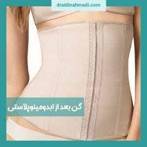 گن بعد از ابدومینوپلاستی - https://draidinahmadi.com/