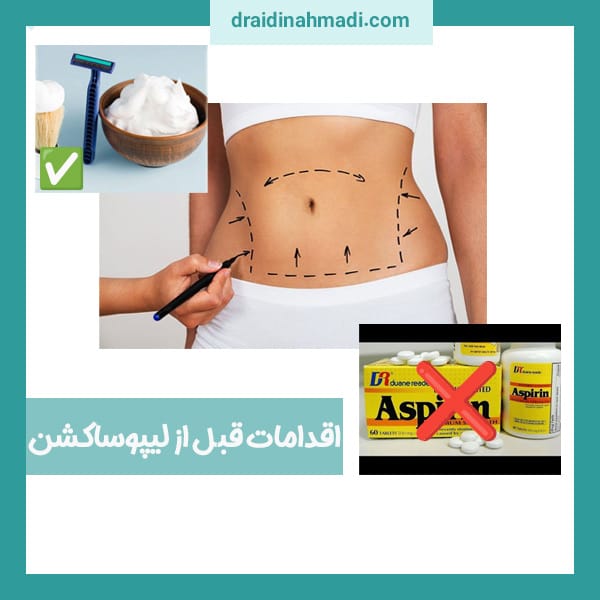 اقدامات قبل از لیپوساکشن
