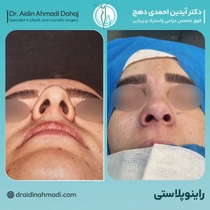 عکس نمونه کار عمل بینی