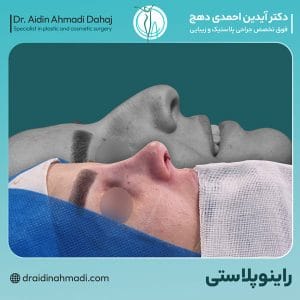 عکس نمونه کار عمل بینی