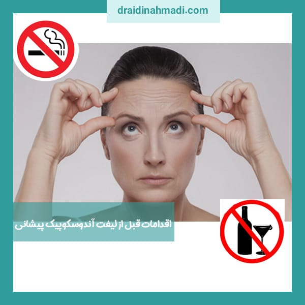 مراقبت های بعد از لیفت آندوسکوپیک پیشانی