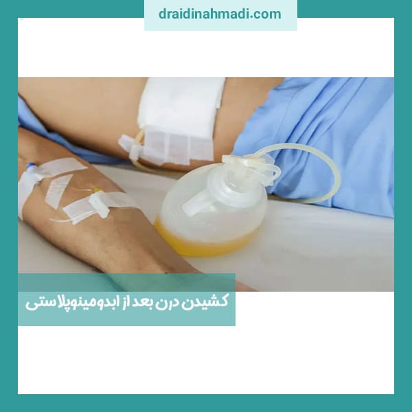 کشیدن درن بعد از ابدومینوپلاستی