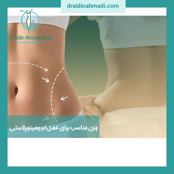 وزن مناسب برای عمل ابدومینوپلاستی