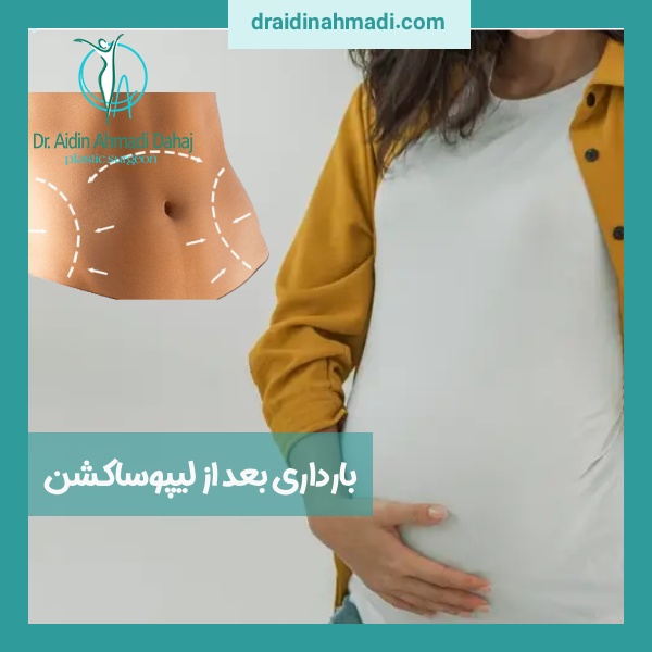 بارداری بعد از لیپوساکشن