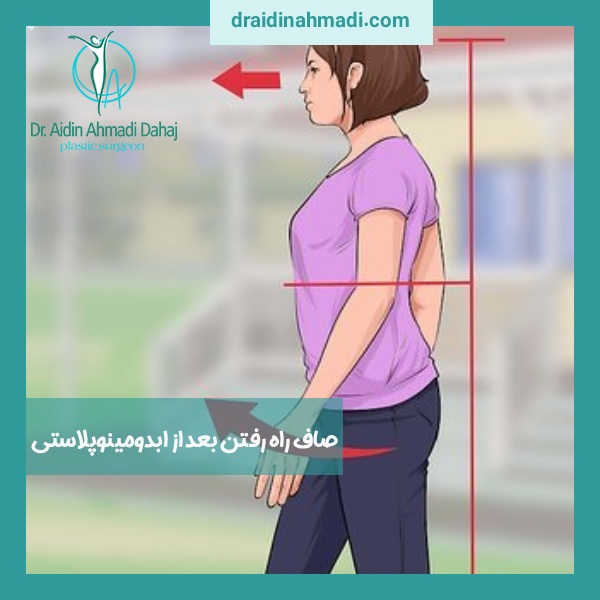 صاف راه رفتن بعد از ابدومینوپلاستی