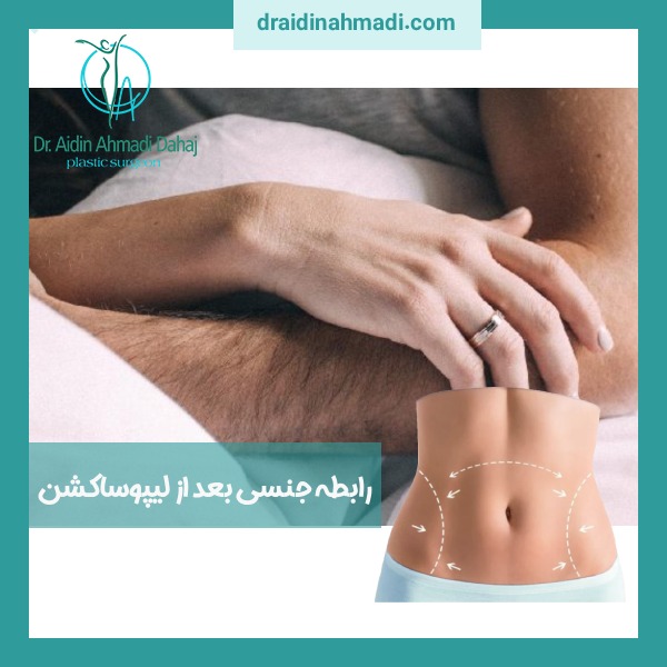 رابطه جنسی بعد از لیپوساکشن