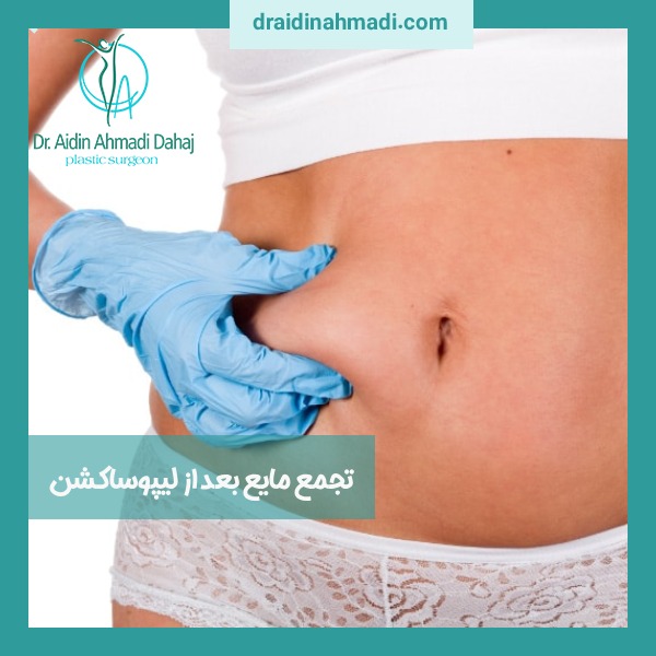 تجمع مایع بعد از لیپوساکشن