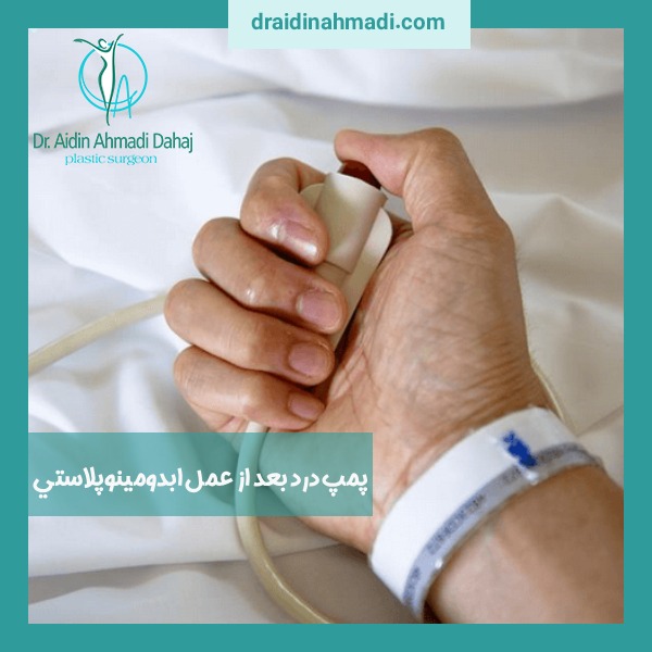 پمپ درد بعد از عمل ابدومينوپلاستي