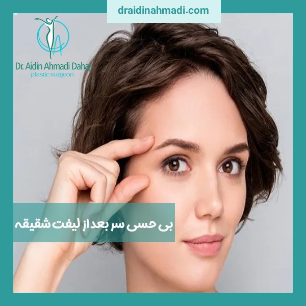 بی حسی سر بعد از لیفت شقیقه