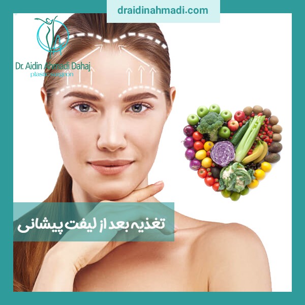 تغذیه بعد از لیفت پیشانی